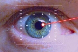 eye-iris-laser-correction