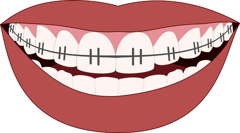 orthodontics-smile-teeth-dentist